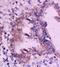 Retinoic Acid Receptor Alpha antibody, orb11326, Biorbyt, Immunohistochemistry paraffin image 
