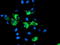 Sirtuin 5 antibody, TA503233, Origene, Immunofluorescence image 