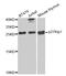 Cyclin Dependent Kinase Inhibitor 1B antibody, MBS125745, MyBioSource, Western Blot image 