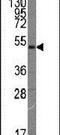 Fms Related Tyrosine Kinase 4 antibody, MA5-11168, Invitrogen Antibodies, Western Blot image 