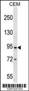 Dipeptidyl Peptidase 4 antibody, 59-488, ProSci, Western Blot image 