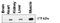 Amylo-Alpha-1, 6-Glucosidase, 4-Alpha-Glucanotransferase antibody, LS-C99696, Lifespan Biosciences, Western Blot image 