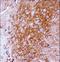 Neurotrophic Receptor Tyrosine Kinase 2 antibody, LS-C164509, Lifespan Biosciences, Immunohistochemistry frozen image 