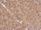 Protein Phosphatase 2 Scaffold Subunit Aalpha antibody, NBP2-19907, Novus Biologicals, Immunohistochemistry frozen image 