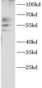 ATP Binding Cassette Subfamily E Member 1 antibody, FNab10351, FineTest, Western Blot image 