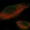 Kinesin Family Member 18B antibody, NBP1-90882, Novus Biologicals, Immunofluorescence image 