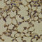 GTase antibody, LS-C335668, Lifespan Biosciences, Immunohistochemistry paraffin image 