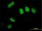 SURP And G-Patch Domain Containing 2 antibody, H00010147-M01, Novus Biologicals, Immunofluorescence image 
