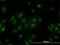 Mediator Complex Subunit 15 antibody, H00051586-M02, Novus Biologicals, Immunocytochemistry image 