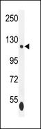 SWI/SNF Related, Matrix Associated, Actin Dependent Regulator Of Chromatin, Subfamily A, Member 5 antibody, 55-929, ProSci, Western Blot image 