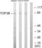 DNA Topoisomerase III Beta antibody, abx013350, Abbexa, Western Blot image 