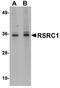 Arginine And Serine Rich Coiled-Coil 1 antibody, A12655, Boster Biological Technology, Western Blot image 