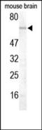 Deltex E3 Ubiquitin Ligase 1 antibody, 250492, Abbiotec, Western Blot image 