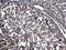 Protein Disulfide Isomerase Family A Member 3 antibody, GTX113719, GeneTex, Immunohistochemistry paraffin image 