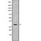 Acyl-CoA Binding Domain Containing 4 antibody, abx147967, Abbexa, Western Blot image 