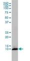 FKBP Prolyl Isomerase 1A antibody, H00002280-M01, Novus Biologicals, Western Blot image 