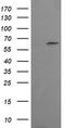 Chaperonin Containing TCP1 Subunit 8 Like 2 antibody, TA505307AM, Origene, Western Blot image 