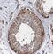 Hexokinase 1 antibody, FNab03847, FineTest, Immunohistochemistry frozen image 