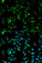 Tropomyosin alpha-3 chain antibody, 14-242, ProSci, Immunofluorescence image 