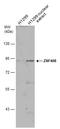 Zinc Finger Protein 408 antibody, GTX116843, GeneTex, Western Blot image 