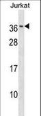 RAB8B, Member RAS Oncogene Family antibody, LS-C158796, Lifespan Biosciences, Western Blot image 