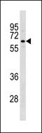 TATA-Box Binding Protein Associated Factor, RNA Polymerase I Subunit B antibody, PA5-49295, Invitrogen Antibodies, Western Blot image 