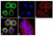 Transforming Growth Factor Beta Receptor 2 antibody, 710715, Invitrogen Antibodies, Immunofluorescence image 