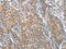 Tumor Protein P53 Binding Protein 2 antibody, CSB-PA287469, Cusabio, Immunohistochemistry paraffin image 