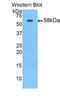 ATP Binding Cassette Subfamily B Member 1 antibody, LS-C295807, Lifespan Biosciences, Western Blot image 