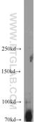 Spleen Associated Tyrosine Kinase antibody, 22206-1-AP, Proteintech Group, Western Blot image 