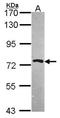 Protein Arginine Methyltransferase 5 antibody, NBP2-19937, Novus Biologicals, Western Blot image 