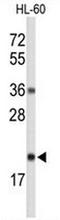 Ribonuclease H2 Subunit C antibody, AP53698PU-N, Origene, Western Blot image 