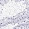 IKAROS Family Zinc Finger 1 antibody, NBP2-38241, Novus Biologicals, Immunohistochemistry paraffin image 