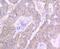 GIT ArfGAP 1 antibody, A02140-2, Boster Biological Technology, Immunohistochemistry paraffin image 