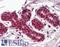 Splicing factor 1 antibody, LS-B3095, Lifespan Biosciences, Immunohistochemistry paraffin image 