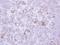 Matrix Metallopeptidase 13 antibody, GTX100665, GeneTex, Immunohistochemistry paraffin image 