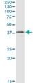 Calponin 3 antibody, H00001266-M03, Novus Biologicals, Western Blot image 