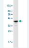 Plakophilin 3 antibody, H00011187-M04-100ug, Novus Biologicals, Western Blot image 