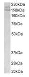 Protein Kinase C Delta antibody, orb14670, Biorbyt, Western Blot image 