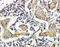 Caspase 8 antibody, LS-C312687, Lifespan Biosciences, Immunohistochemistry paraffin image 
