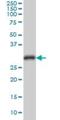 Cyclin Dependent Kinase 1 antibody, H00000983-M04, Novus Biologicals, Western Blot image 