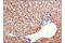 Acetyl-CoA Carboxylase Beta antibody, 11818S, Cell Signaling Technology, Immunohistochemistry paraffin image 