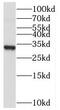 Collectrin, Amino Acid Transport Regulator antibody, FNab08776, FineTest, Western Blot image 