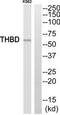 Thrombomodulin antibody, TA314621, Origene, Western Blot image 