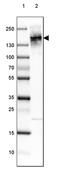 Leucine Rich Repeats And Immunoglobulin Like Domains 1 antibody, PA5-52860, Invitrogen Antibodies, Western Blot image 