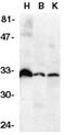 TNF Receptor Superfamily Member 6b antibody, GTX28405, GeneTex, Western Blot image 