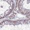 Proteasome 26S Subunit, Non-ATPase 11 antibody, NBP1-82700, Novus Biologicals, Immunohistochemistry frozen image 