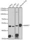 Mitogen-activated protein kinase 7 antibody, A02812, Boster Biological Technology, Western Blot image 