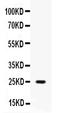 Peptidase Inhibitor 3 antibody, PB9957, Boster Biological Technology, Western Blot image 