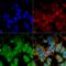 Potassium Voltage-Gated Channel Subfamily J Member 8 antibody, LS-C773810, Lifespan Biosciences, Immunocytochemistry image 